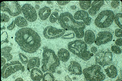 Oolite under photomicrograph